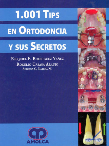 Tips en ortodoncia y Secretos - Rodríguez - Casasa