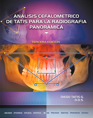 Análisis Cefalométrico para Rx Panorámica - Tatis